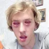 Örnek Resim
